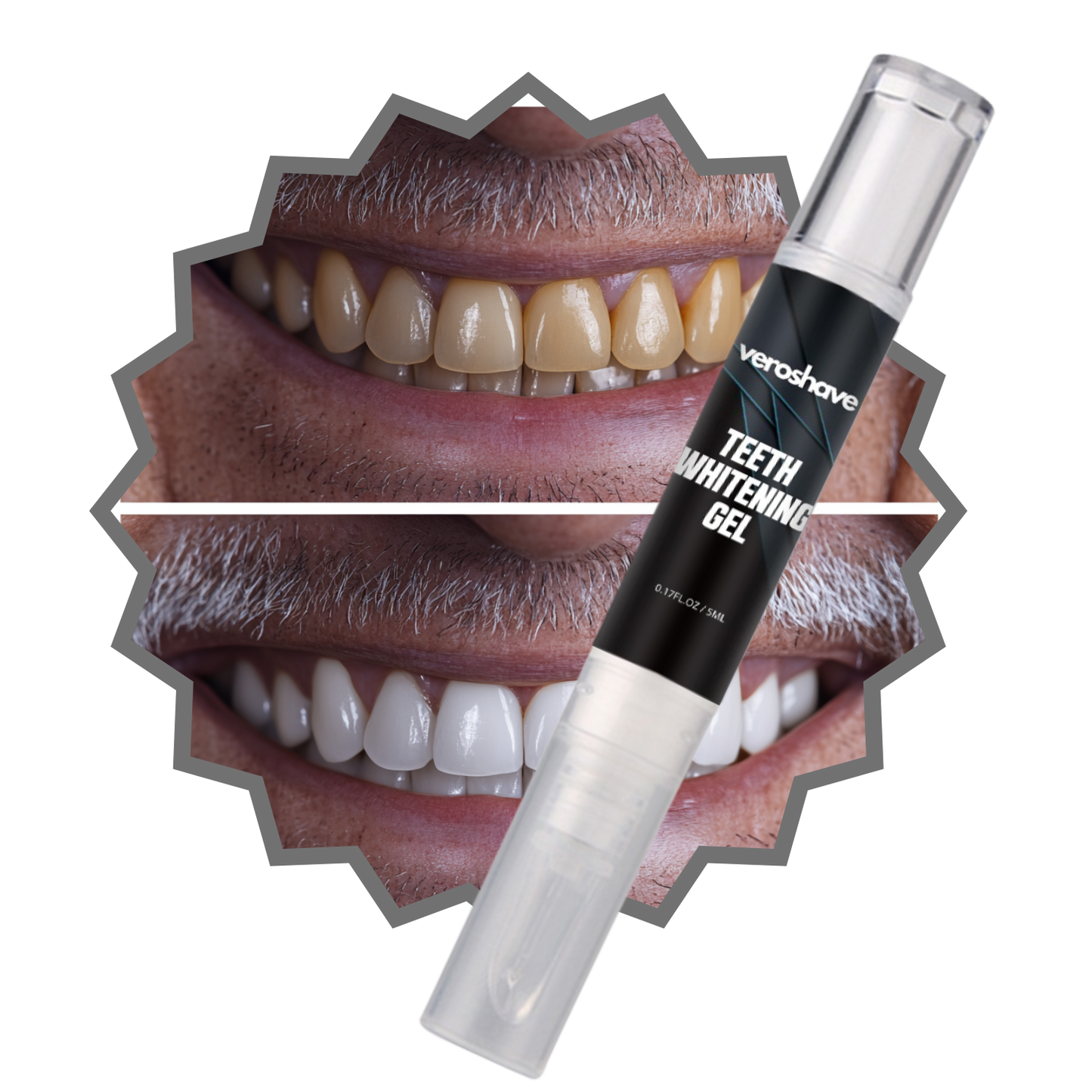 Teeth Whitening Gel