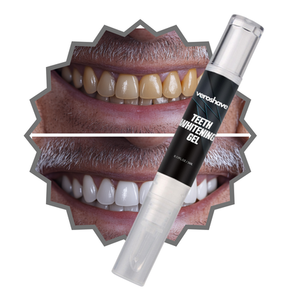 Teeth Whitening Gel